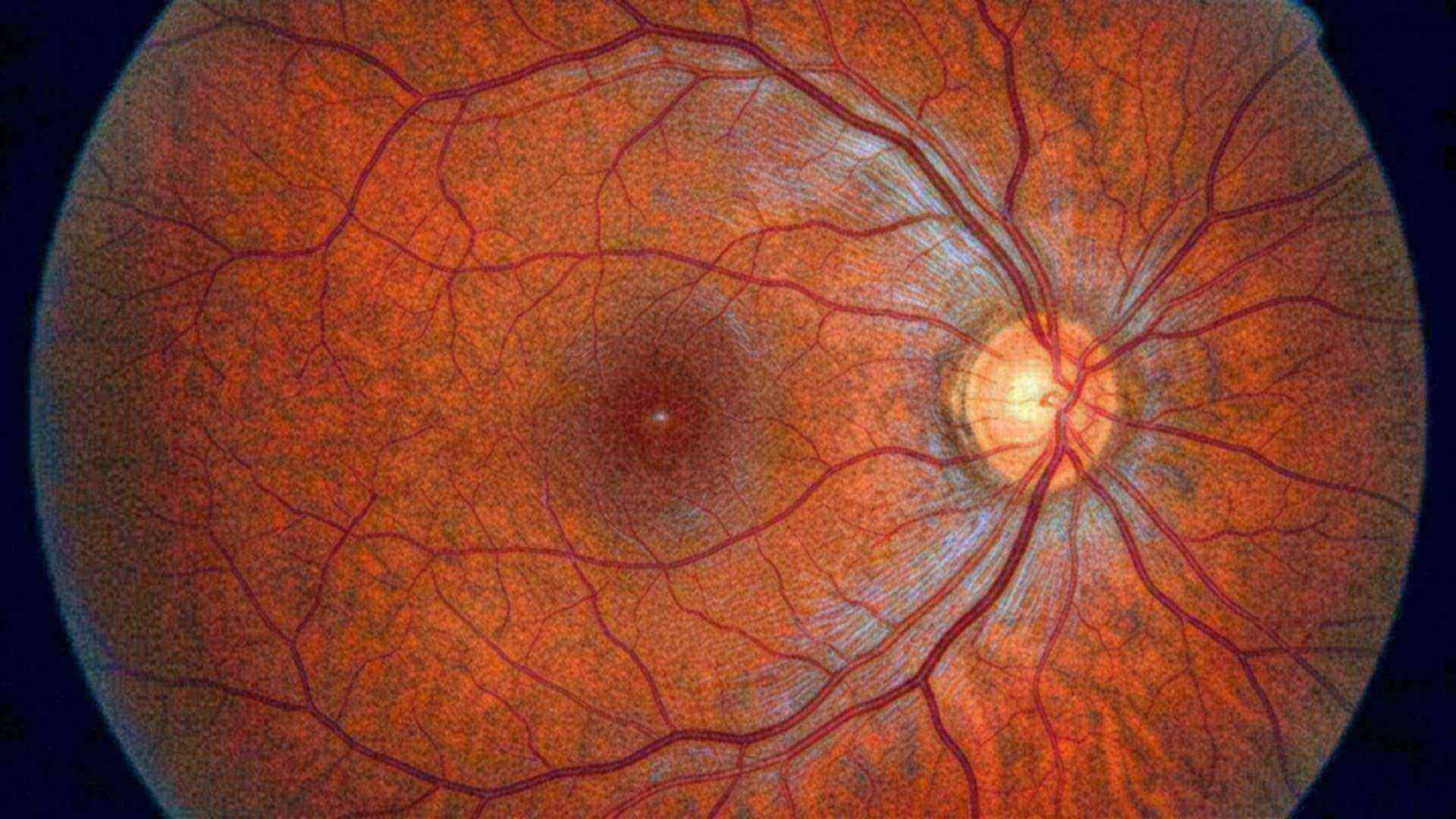 La rétine, l'objection et sa réponse — Homo sapiens